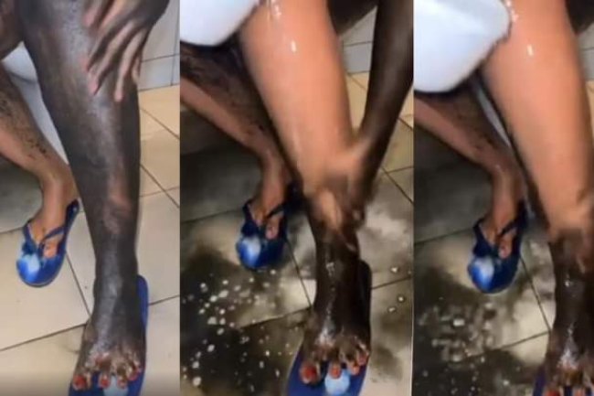 SEE THE BLEACHING PROCEDURE NIGERIAN WOMEN NOW USE TO INSTANTLY WHITEN THEIR SKIN IN 1 HOUR