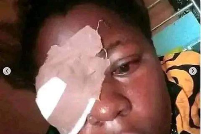 MY BOYFRIEND HAS A DRINKING PROBLEM, WHEN HE IS DRUNK HE USUALLY BEATS ME UP AND I STILL LOVE HIM SO MUCH