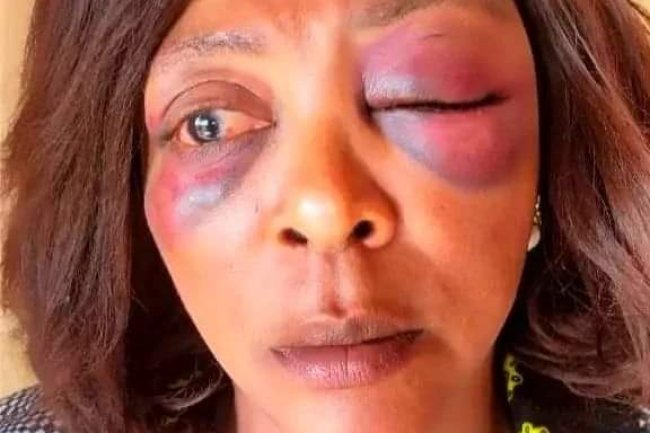 NSCDC PERSONNEL ALLEGEDLY ASSAULTS WOMAN IN PLATEAU STATE