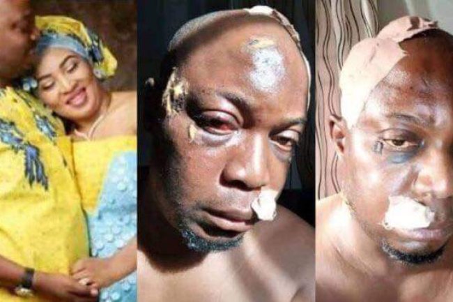 NIGERIAN MAN CRIES OUT FOR HELP AFTER HIS WIFE BEATS HIM BEYOND RECOGNITION, NEARLY KILLING HIM 