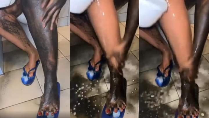 SEE THE BLEACHING PROCEDURE NIGERIAN WOMEN NOW USE TO INSTANTLY WHITEN THEIR SKIN IN 1 HOUR