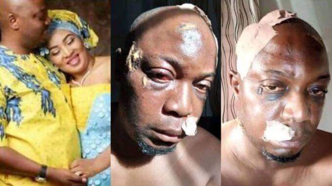 NIGERIAN MAN CRIES OUT FOR HELP AFTER HIS WIFE BEATS HIM BEYOND RECOGNITION, NEARLY KILLING HIM 