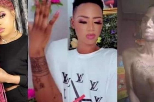 MAN WHO DREW BOBRISKY ON HIS ARM SEEKS HELP AS HE SUFFERS AN AILMENT BECAUSE OF THE TATTOO