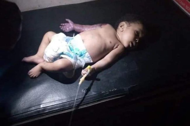 FATHER ALLEGEDLY BEATS HIS 2-MONTH-OLD SON WITH HANGER IN IMO FOR DISTURBING HIS SLEEP, BREAKS THE BABY'S ARM LEADING TO AMPUTATION 