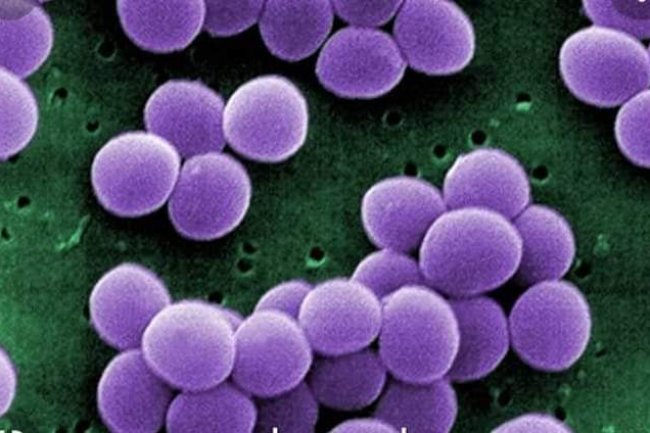 SOLUTION TO ANY KIND OF STAPHYLOCOCCUS WITHIN 21 DAYS