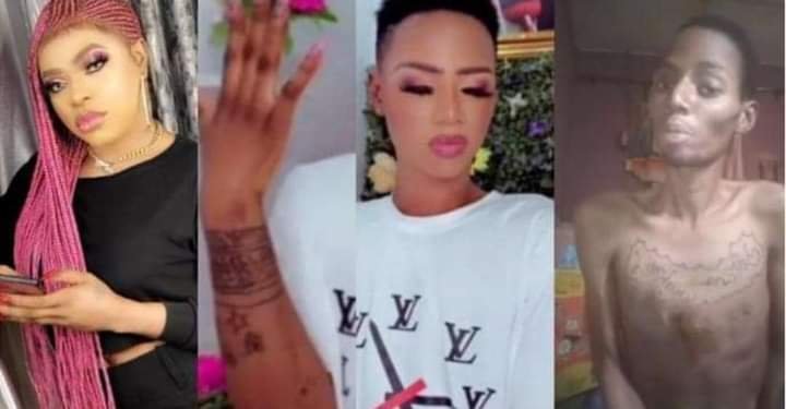 MAN WHO DREW BOBRISKY ON HIS ARM SEEKS HELP AS HE SUFFERS AN AILMENT BECAUSE OF THE TATTOO