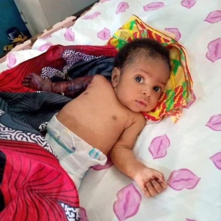 FATHER ALLEGEDLY BEATS HIS 2-MONTH-OLD SON WITH HANGER IN IMO FOR DISTURBING HIS SLEEP, BREAKS THE BABY'S ARM LEADING TO AMPUTATION 