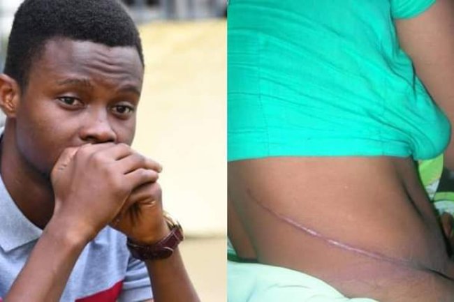 “MY GIRLFRIEND DONATED HER KIDNEY TO SAVE ME, BUT I’M NO LONGER IN LOVE WITH HER, WHAT SHOULD I DO?” – NIGERIAN MAN 