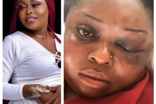 MAN BEATS, BLINDS EX-GIRLFRIEND FOR REFUSING TO MARRY HIM   