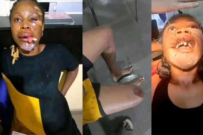 “I WAS PUSHED OUT OF A RUNNING VEHICLE BY ROBBERS ON CHRISTMAS DAY WHILE ON MY WAY FROM TOWN” – NIGERIAN WOMAN CRIES OUT IN PAIN