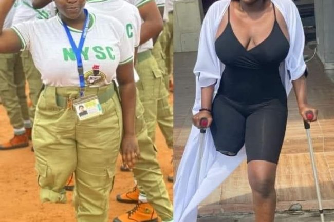 "I SERVE NIGERIA WITH ALL MY STRENGTH" – PHYSICAL CHALLENGE BEAUTY GIRL, DORIS AKONANYA