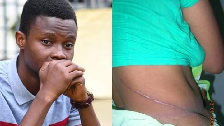 “MY GIRLFRIEND DONATED HER KIDNEY TO SAVE ME, BUT I’M NO LONGER IN LOVE WITH HER, WHAT SHOULD I DO?” – NIGERIAN MAN 