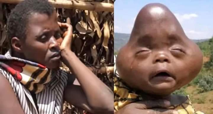 MEET LITTLE BOY WHO HAS AN ALIEN SHAPE OF HEAD