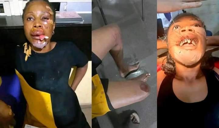 “I WAS PUSHED OUT OF A RUNNING VEHICLE BY ROBBERS ON CHRISTMAS DAY WHILE ON MY WAY FROM TOWN” – NIGERIAN WOMAN CRIES OUT IN PAIN