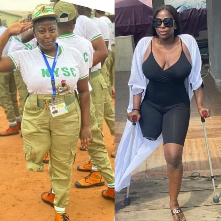 "I SERVE NIGERIA WITH ALL MY STRENGTH" – PHYSICAL CHALLENGE BEAUTY GIRL, DORIS AKONANYA