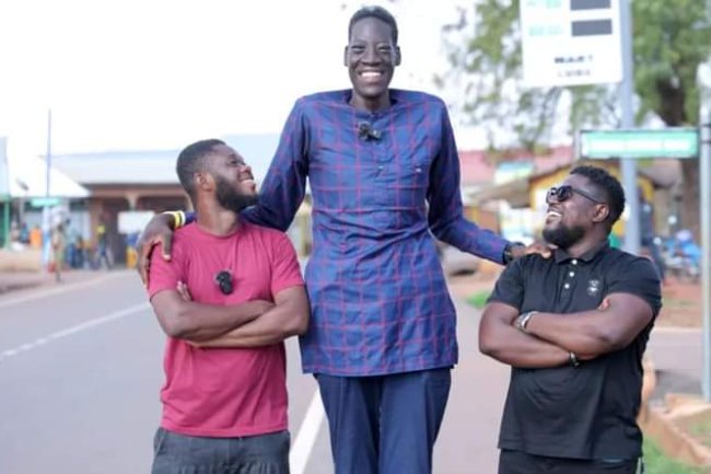 GIGANTISM AND ACROMEGALY: MEET THE TWO RARE ABNORMAL GROWTH DISEASES IN HUMANS 