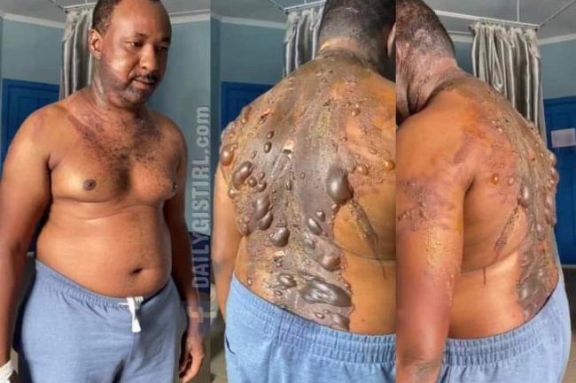 WIFE POURS HOT WATER ON HUSBAND FOR BUYING IPHONE FOR SIDE CHICK IN IMO