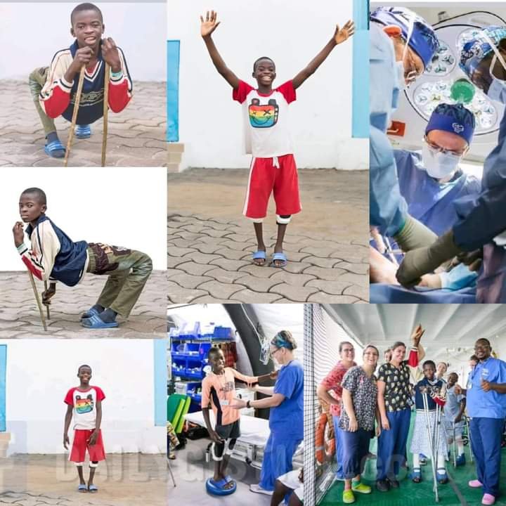 NIGERIAN DISABLED BOY WITH EXTREME BOW LEGS LOOKS TOTALLY DIFFERENT AFTER UNDERGOING SUCCESSFUL SURGERY 