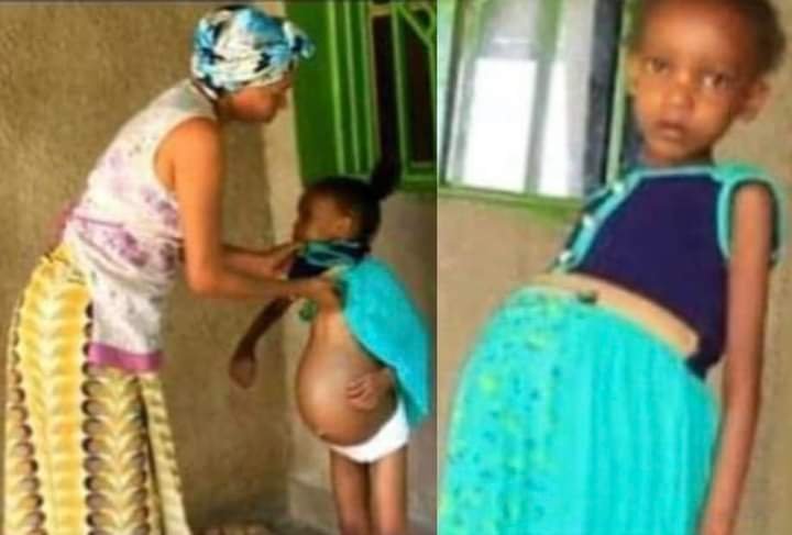 SAD AND SHOCKING MOMENT AS 5-YEAR-OLD BABY GIRL IS CONFIRMED PREGNANT