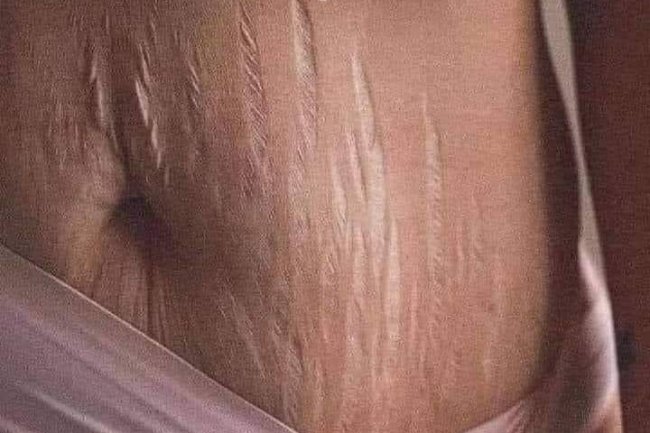 REMEMBER HOW BEAUTIFUL, SMOOTH, AND SCULPTED HER BODY WAS AT THE BEGINNING OF YOUR MARRIAGE