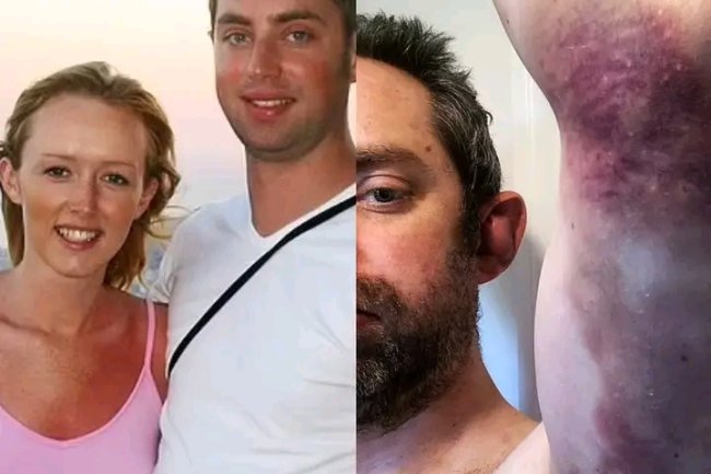 I WORE MAKE-UP TO HIDE BRUISES FROM WIFE’S BEATING FOR 20 YEARS - MAN