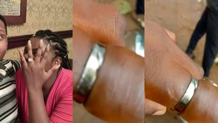 NIGERIAN LADY LOSES ONE OF HER FINGER FROM WEARING HER FIANCÉ'S ENGAGEMENT RING FOR 10 YEARS