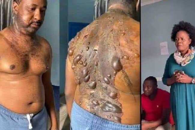 JEALOUS WIFE POURS HOT WATER ON HUSBAND AFTER BUYING NEW PHONE FOR HIS SIDECHIC IN IMO
