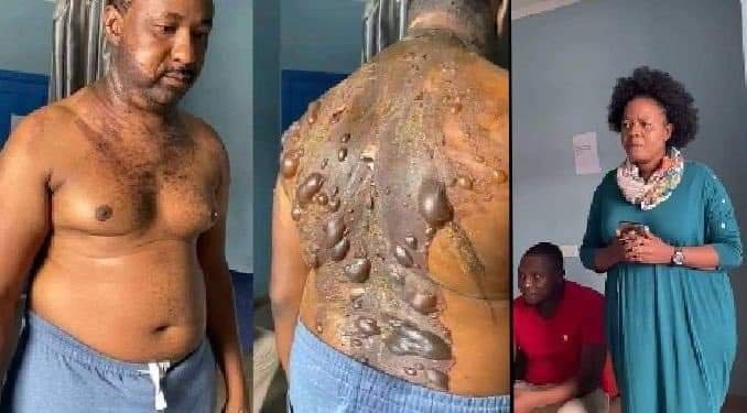 JEALOUS WIFE POURS HOT WATER ON HUSBAND AFTER BUYING NEW PHONE FOR HIS SIDECHIC IN IMO