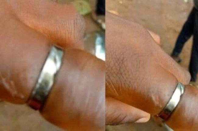 REACTIONS AS LADY ALMOST LOSES FINGER FROM WEARING HER FIANCE'S ENGAGEMENT RING FOR 10 YEARS
