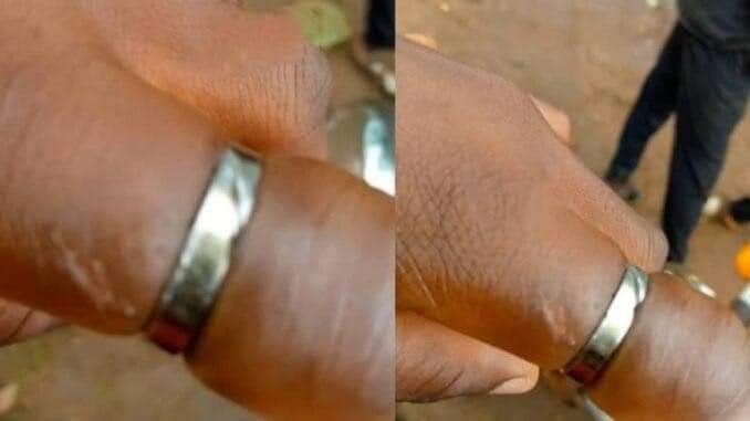 REACTIONS AS LADY ALMOST LOSES FINGER FROM WEARING HER FIANCE'S ENGAGEMENT RING FOR 10 YEARS