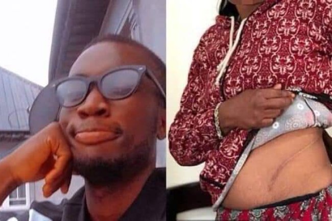 MY GIRLFRIEND DONATED A KIDNEY TO ME WHEN I WAS DYING, BUT I DON'T LOVE HER ANYMORE – PLEASE ADVICE ME 