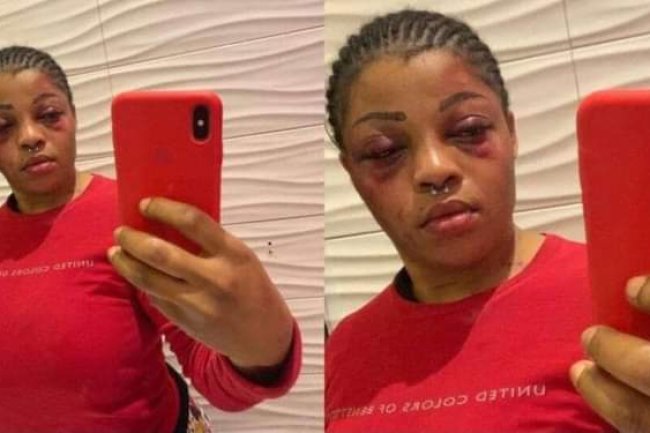 I LOVE BEATING IF MY BOYFRIEND DOESN’T BEAT ME A DAY, I WILL BE SO SICK – NIGERIAN LADY SPEAKS