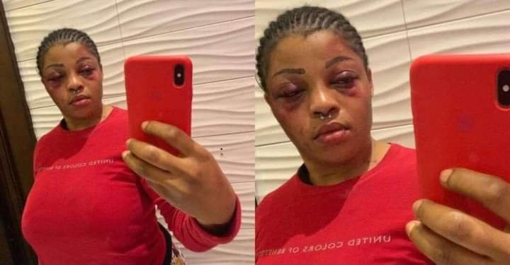 I LOVE BEATING IF MY BOYFRIEND DOESN’T BEAT ME A DAY, I WILL BE SO SICK – NIGERIAN LADY SPEAKS